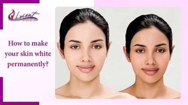 Can Ice whiten skin?