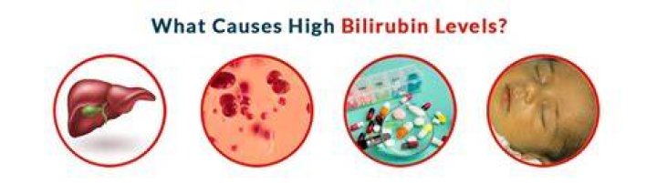 Can you die from high bilirubin?