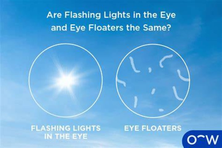 How long does it take for eye flashes to go away?