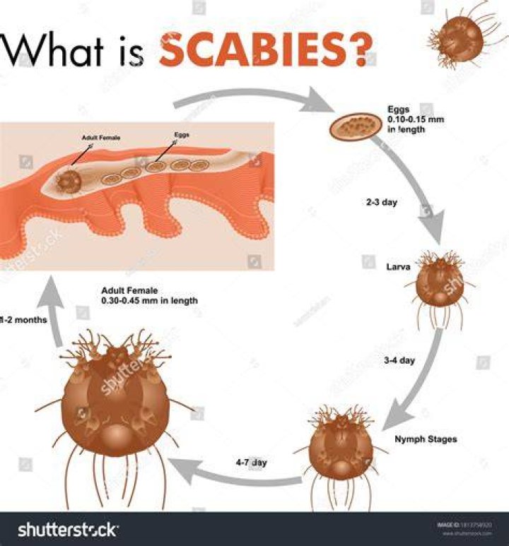 Is scabies considered a sexually transmitted disease?